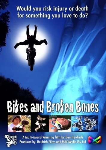 Bikes and Broken Bones 